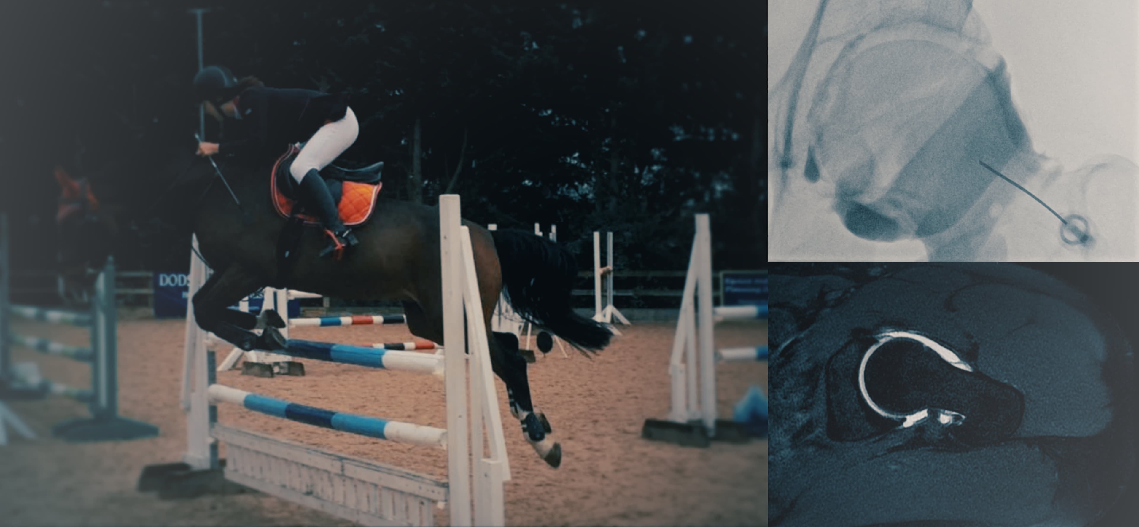 Radiology, Horseriding, Hip arthrogram, MRI arthrogram