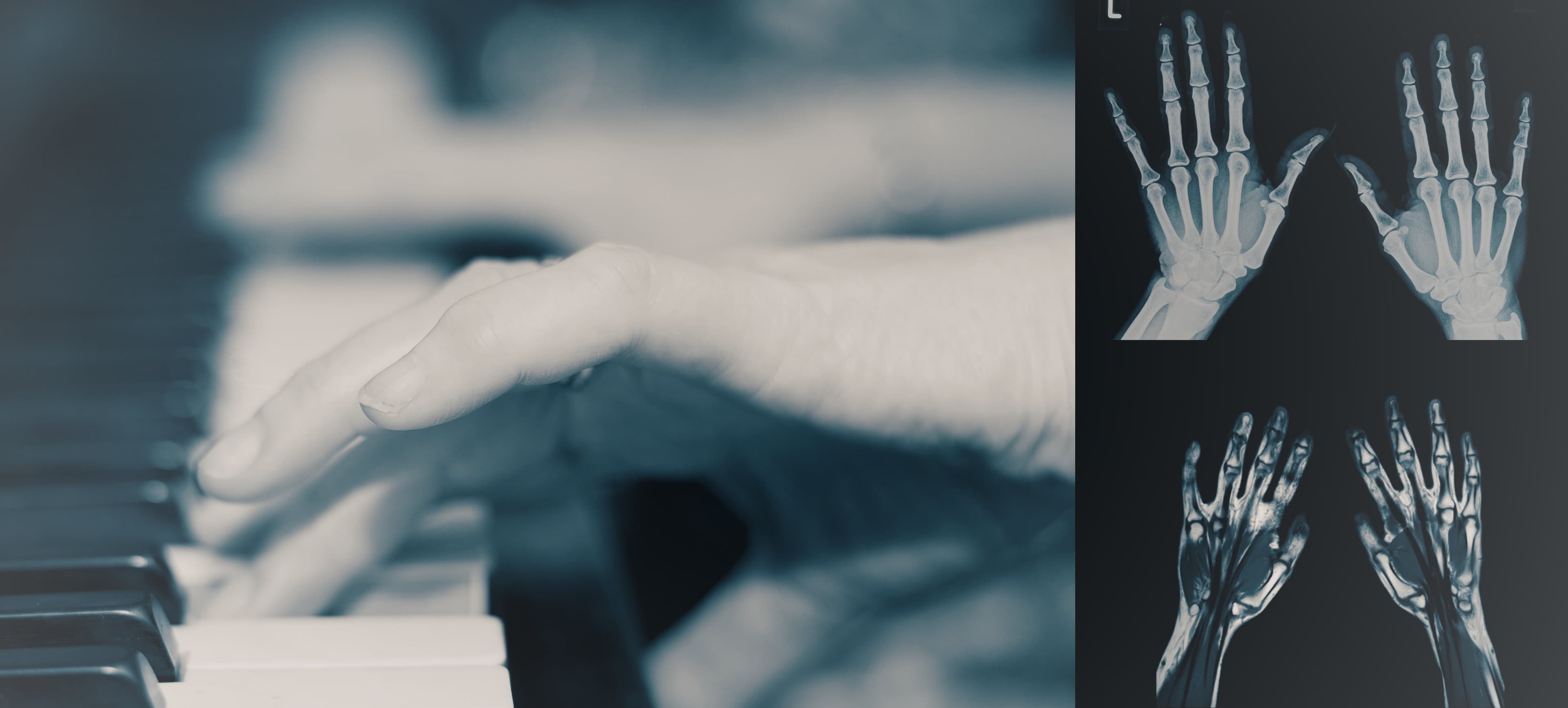 Radiology, piano, hands, X-rays, MRI