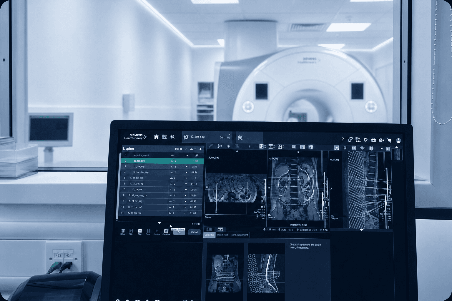 MRI scanner control screen displaying lumbar spine sequences with the scanner visible through the viewing window